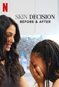 Skin Decision Before After